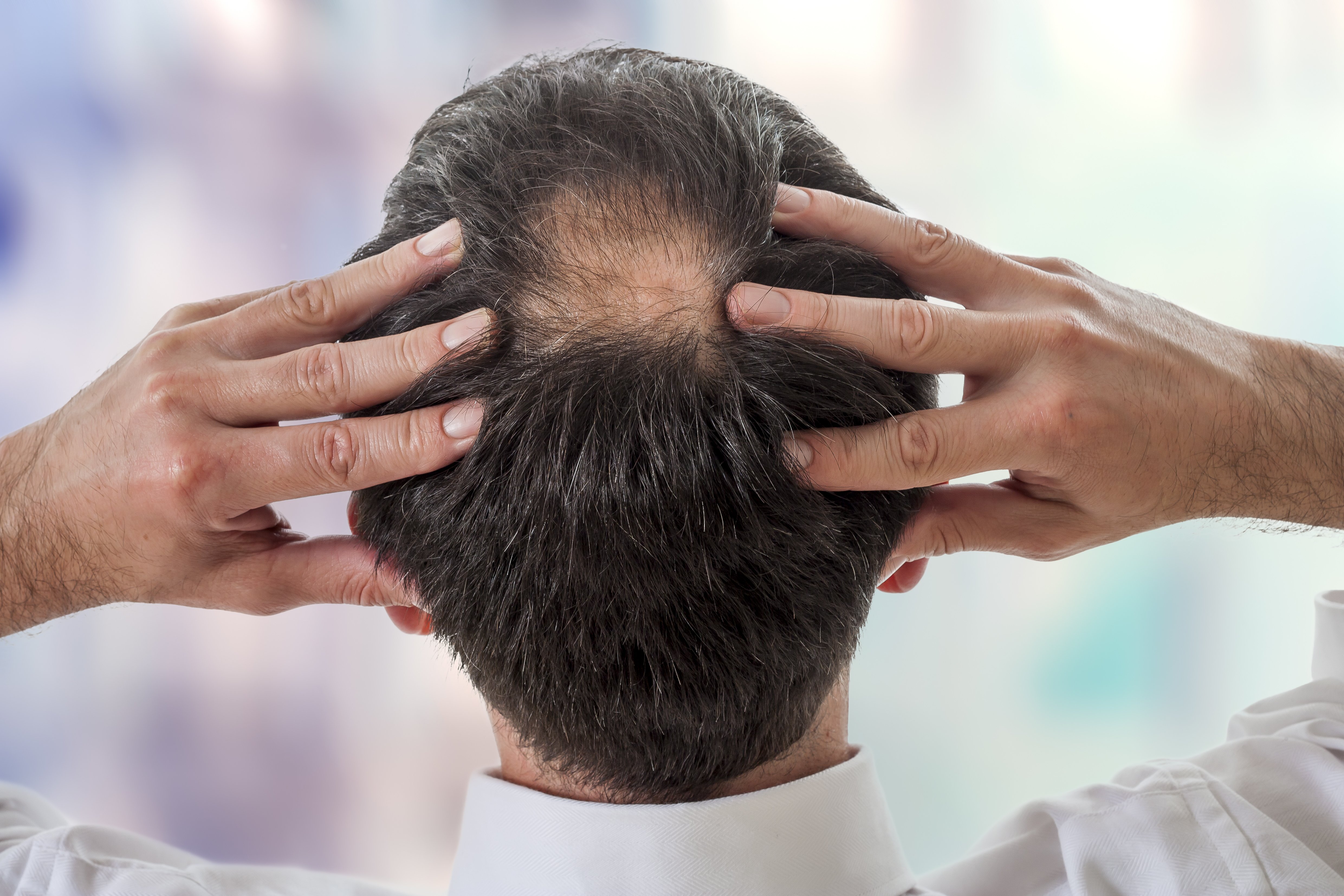 The Hair Loss Drug Propecia Carries Risks: How Does It Help Treat Hair Loss?